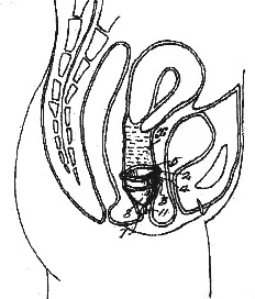 Chalmer's Patent
